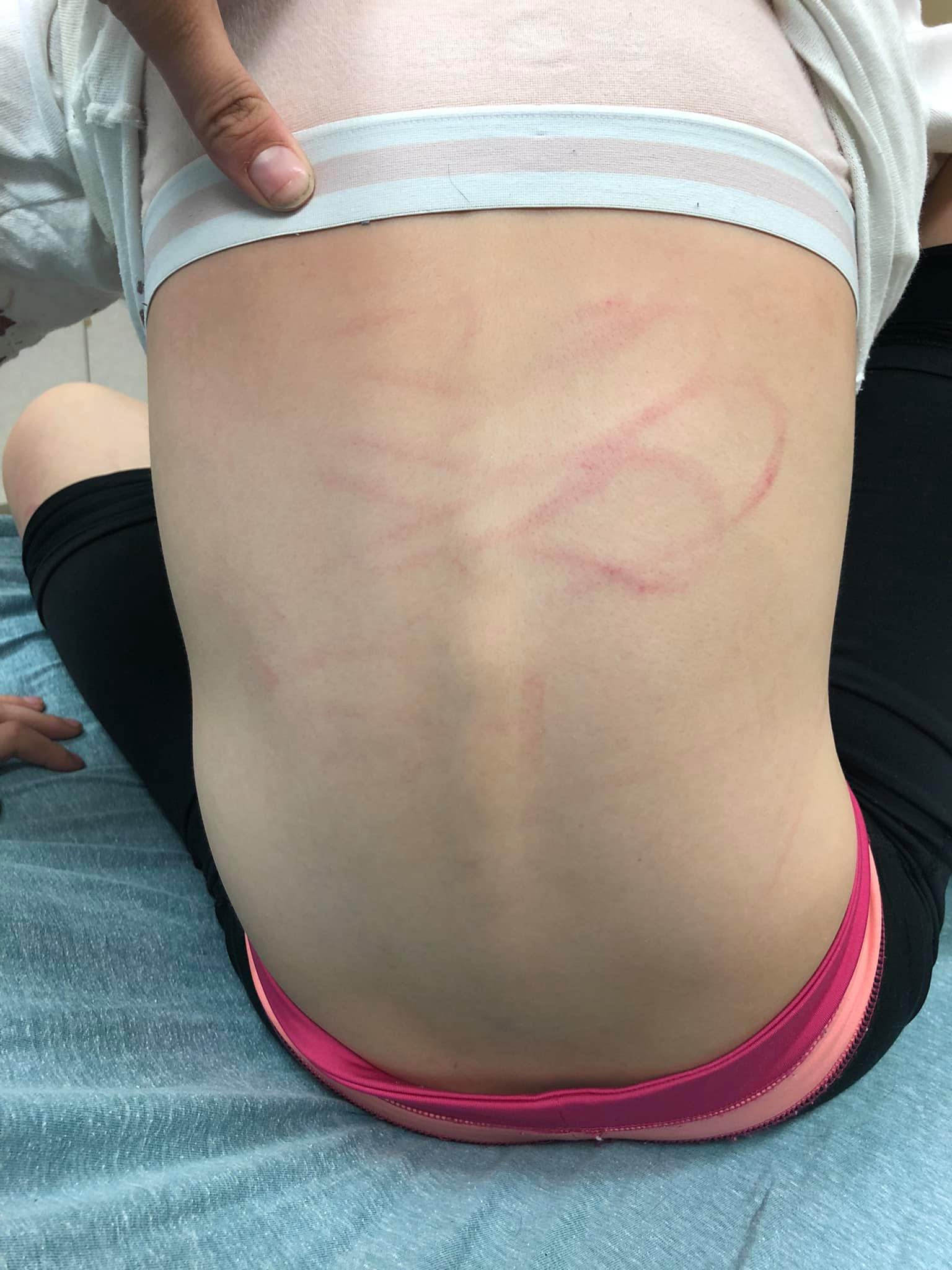 Two teenagers charged after mom's viral plea about torture of her 10-year-old-daughter