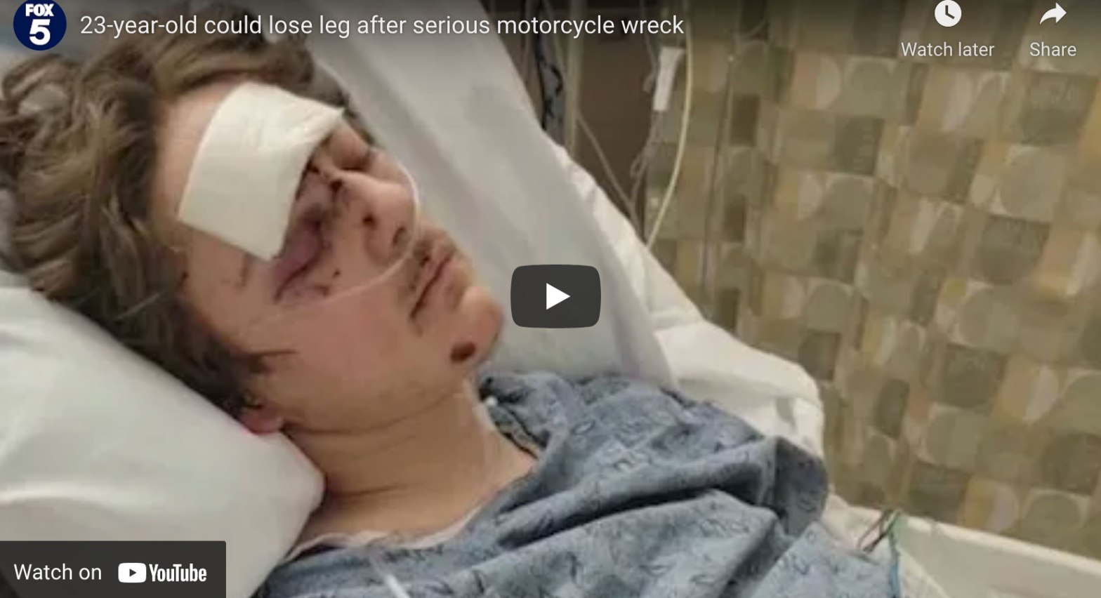 23-year-old could lose his leg after serious motorcycle crash, biker news for January 10th, 2022